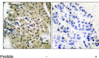 Immunohistochemistry (Formalin/PFA-fixed paraffin-embedded sections) - Anti-HDAC5 antibody (AB55403)