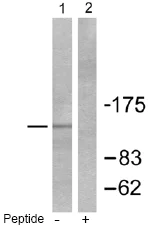 Western blot - Anti-HDAC5 antibody (AB55403)