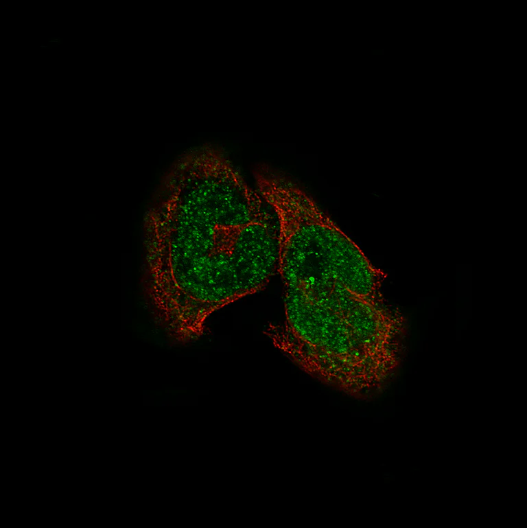 Immunocytochemistry/ Immunofluorescence - Anti-HDAC5 Antibody [CL8121] (AB327125)