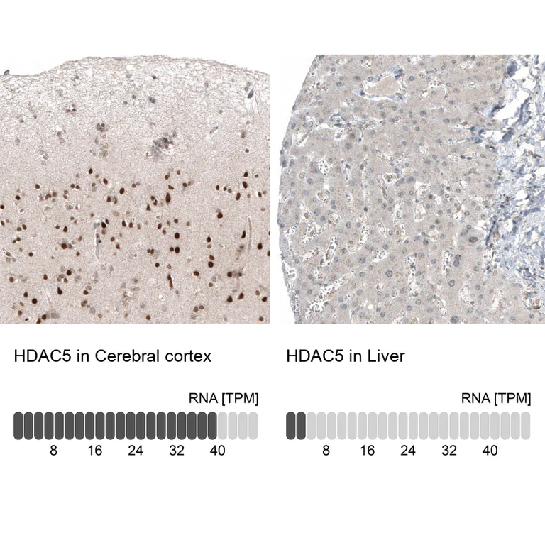 Immunohistochemistry (Formalin/PFA-fixed paraffin-embedded sections) - Anti-HDAC5 Antibody [CL8121] (AB327125)