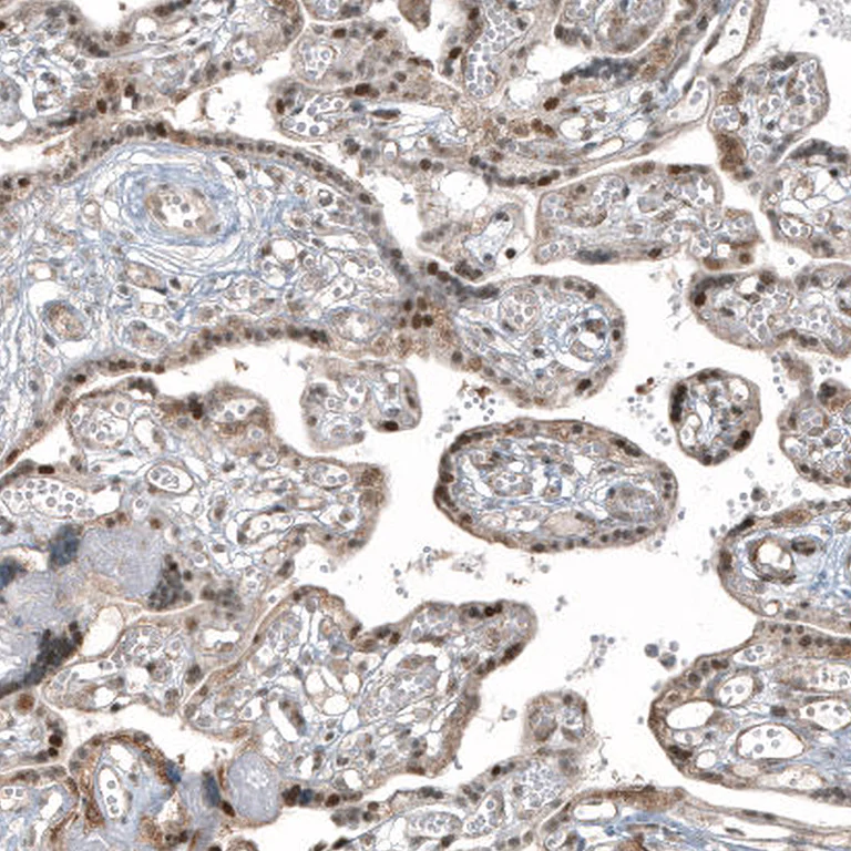 Immunohistochemistry (Formalin/PFA-fixed paraffin-embedded sections) - Anti-HDAC5 Antibody [CL8121] (AB327125)