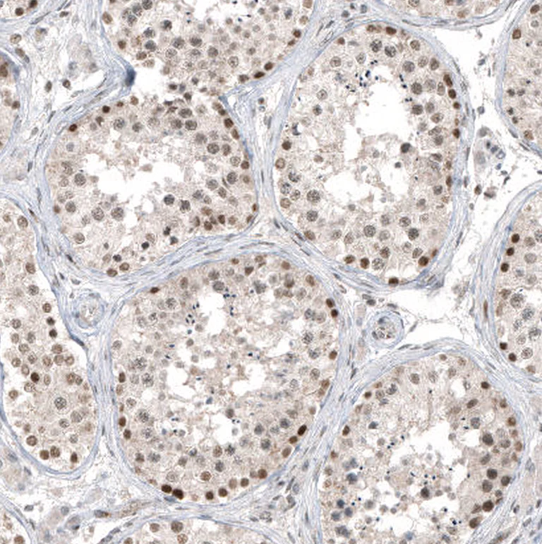 Immunohistochemistry (Formalin/PFA-fixed paraffin-embedded sections) - Anti-HDAC5 Antibody [CL8121] (AB327125)