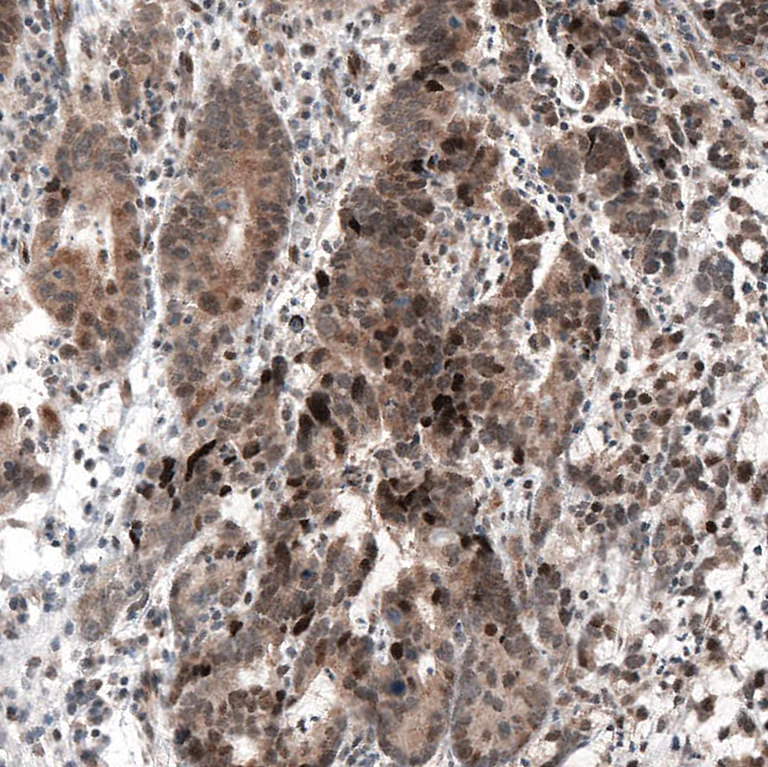 Immunohistochemistry (Formalin/PFA-fixed paraffin-embedded sections) - Anti-HDAC5 Antibody [CL8121] (AB327125)