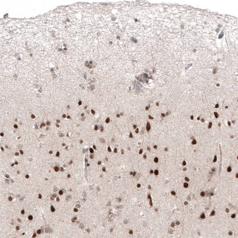 Immunohistochemistry (Formalin/PFA-fixed paraffin-embedded sections) - Anti-HDAC5 Antibody [CL8121] (AB327125)