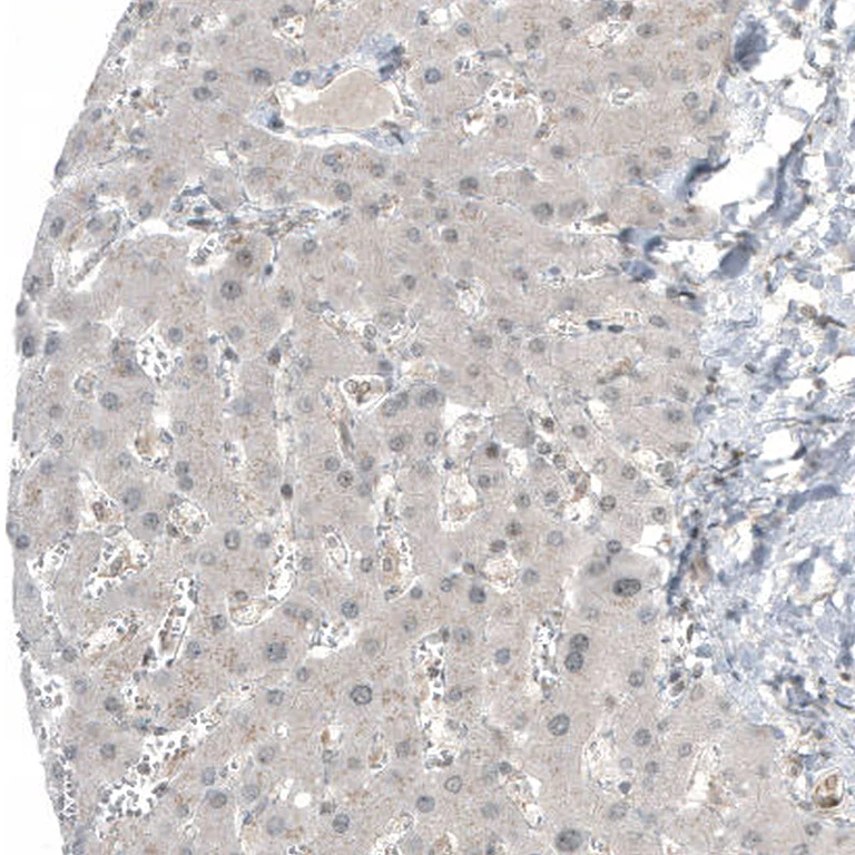 Immunohistochemistry (Formalin/PFA-fixed paraffin-embedded sections) - Anti-HDAC5 Antibody [CL8121] (AB327125)