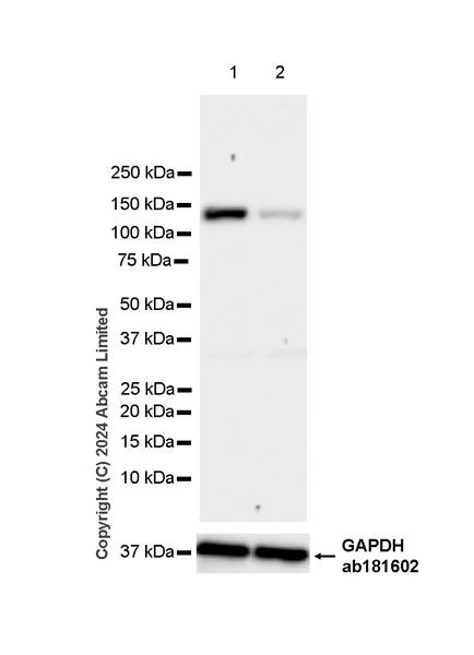 Western blot - Anti-HDAC5 antibody [EPR29216-705] (AB322710)