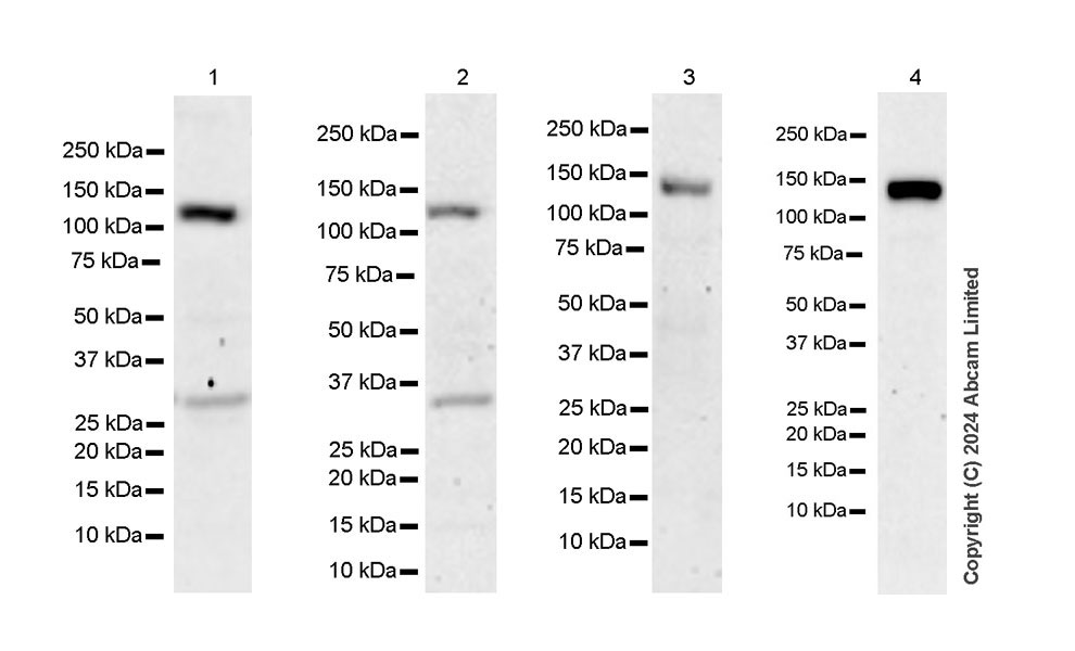 Western blot - Anti-HDAC5 antibody [EPR29216-705] (AB322710), expandable thumbnail
