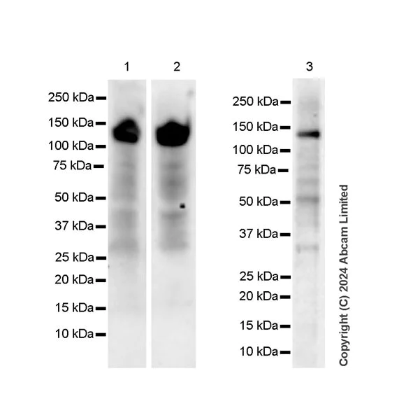 Western blot - Anti-HDAC5 antibody [EPR29216-705] (AB322710)