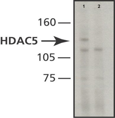 Western blot - Anti-HDAC5 antibody [HDAC5-35] (AB50001)