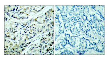 Immunohistochemistry (Formalin/PFA-fixed paraffin-embedded sections) - Anti-HDAC5 (phospho S498) antibody (AB47283)