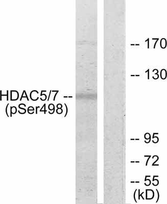 Western blot - Anti-HDAC5 (phospho S498) antibody (AB47283)