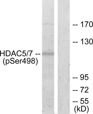 Western blot - Anti-HDAC5 (phospho S498) antibody (AB47283)