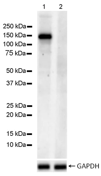 Western blot - Anti-HDAC5 (phospho S498) antibody [EPR22996-105] (AB240644)