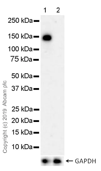 Western blot - Anti-HDAC5 (phospho S498) antibody [EPR22996-105] (AB240644)