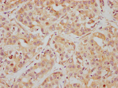 Immunohistochemistry (Formalin/PFA-fixed paraffin-embedded sections) - Anti-HDAC6 antibody [2H12] (AB288366)