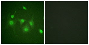 Immunocytochemistry/ Immunofluorescence - Anti-HDAC6 antibody (AB117516), expandable thumbnail