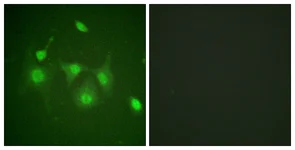 Immunocytochemistry/ Immunofluorescence - Anti-HDAC6 antibody (AB117516)