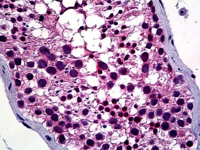 Immunohistochemistry (Formalin/PFA-fixed paraffin-embedded sections) - Anti-HDAC6 antibody (AB117516)