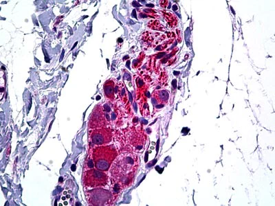 Immunohistochemistry (Formalin/PFA-fixed paraffin-embedded sections) - Anti-HDAC6 antibody (AB117516)