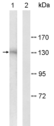 Western blot - Anti-HDAC6 antibody (AB117516), expandable thumbnail