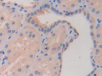 Immunohistochemistry (Formalin/PFA-fixed paraffin-embedded sections) - Anti-HDAC6 antibody (AB233520)