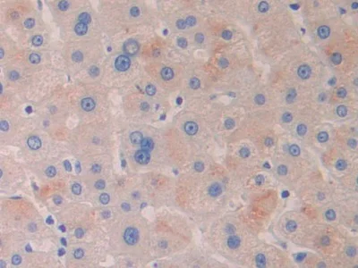 Immunohistochemistry (Formalin/PFA-fixed paraffin-embedded sections) - Anti-HDAC6 antibody (AB233520)