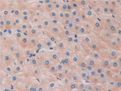 Immunohistochemistry (Formalin/PFA-fixed paraffin-embedded sections) - Anti-HDAC6 antibody (AB233520)