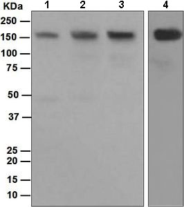 Western blot - Anti-HDAC6 antibody [EPR1698(2)] (AB133493), expandable thumbnail