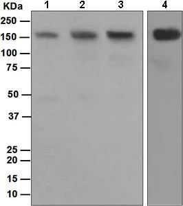 Western blot - Anti-HDAC6 antibody [EPR1698(2)] (AB133493)