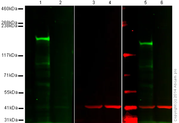 Western blot - Anti-HDAC6 antibody [EPR1698(2)] (AB133493)