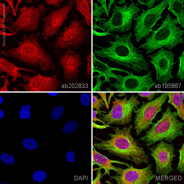 Immunocytochemistry/ Immunofluorescence - Anti-HDAC6 antibody [EPR1698(2)] - BSA and Azide free (AB210472), expandable thumbnail