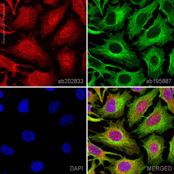 Immunocytochemistry/ Immunofluorescence - Anti-HDAC6 antibody [EPR1698(2)] - BSA and Azide free (AB210472)