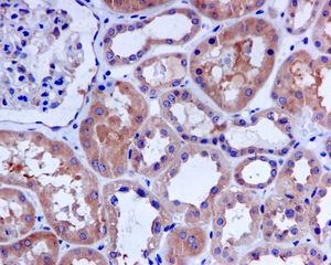 Immunohistochemistry (Formalin/PFA-fixed paraffin-embedded sections) - Anti-HDAC6 antibody [EPR1698(2)] - BSA and Azide free (AB210472), expandable thumbnail