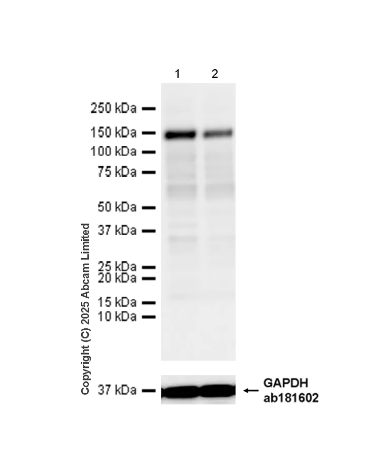 Western blot - Anti-HDAC6 antibody [EPR22951-29] (AB239362)