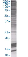 SDS-PAGE - HDAC6 overexpression 293T lysate (whole cell) (AB94173)
