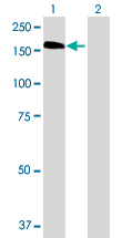 Western blot - HDAC6 overexpression 293T lysate (whole cell) (AB94173), expandable thumbnail