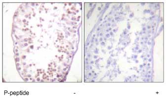 Immunohistochemistry (Formalin/PFA-fixed paraffin-embedded sections) - Anti-HDAC6 (phospho S22) antibody (AB61058), expandable thumbnail