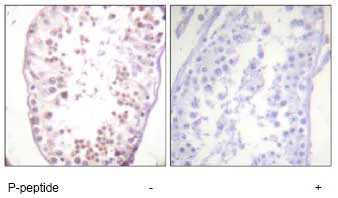 Immunohistochemistry (Formalin/PFA-fixed paraffin-embedded sections) - Anti-HDAC6 (phospho S22) antibody (AB61058)