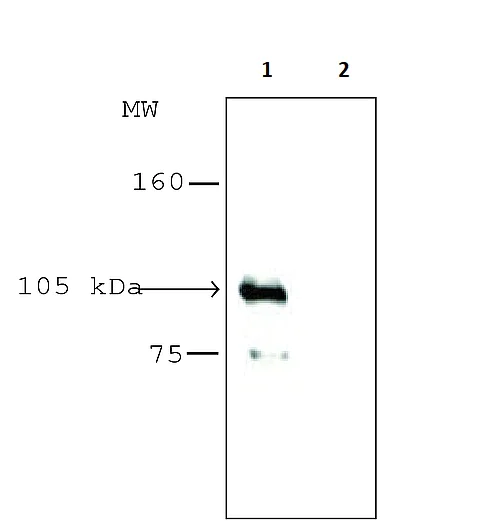 Immunoprecipitation - Anti-HDAC7 antibody (AB12174)