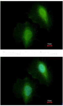 Immunocytochemistry/ Immunofluorescence - Anti-HDAC7 antibody - C-terminal (AB137366)