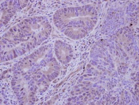 Immunohistochemistry (Formalin/PFA-fixed paraffin-embedded sections) - Anti-HDAC7 antibody - C-terminal (AB137366)