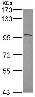 Western blot - Anti-HDAC7 antibody - C-terminal (AB137366), expandable thumbnail