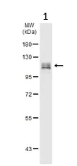 Western blot - Anti-HDAC7 antibody - C-terminal (AB137366)
