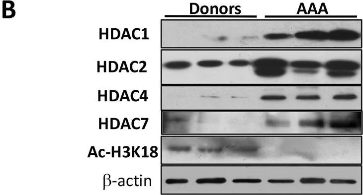 Western blot - Anti-HDAC7 antibody [EPR10922] (AB166911)