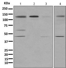 Western blot - Anti-HDAC7 antibody [EPR10922] - BSA and Azide free (AB249392)