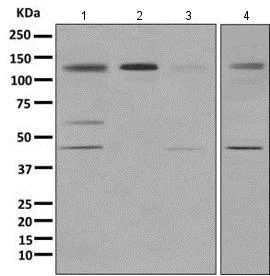Western blot - Anti-HDAC7 antibody [EPR10922] - BSA and Azide free (AB249392)