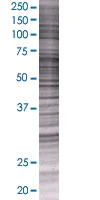 SDS-PAGE - HDAC7 overexpression 293T lysate (whole cell) (AB94174)