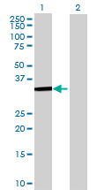 Western blot - HDAC7 overexpression 293T lysate (whole cell) (AB94174), expandable thumbnail
