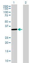 Western blot - HDAC7 overexpression 293T lysate (whole cell) (AB94174)