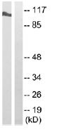 Western blot - Anti-HDAC7 (phospho S155) antibody (AB111390)